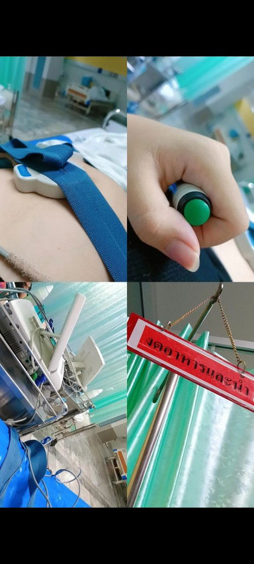 แชร์ประสบการณ์ระงับคลอด