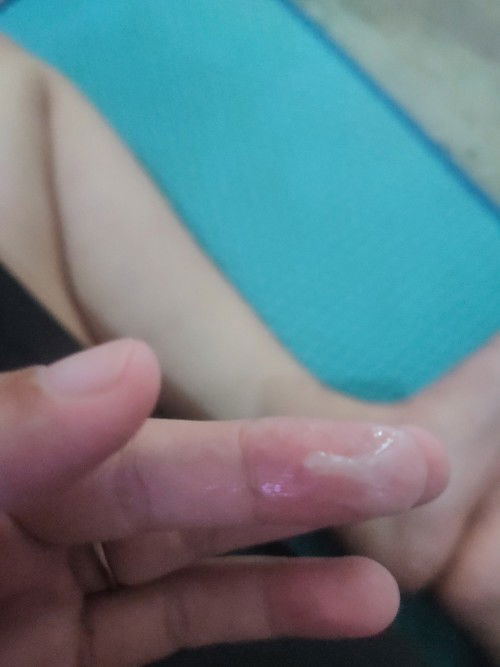 Keluar Lendir putih UK 37W5D