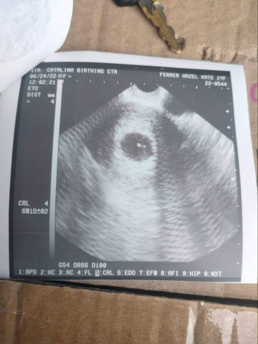 No Heartbeat @ 6weeks