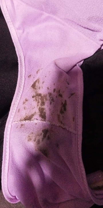 เลือดสีน้ำตาล