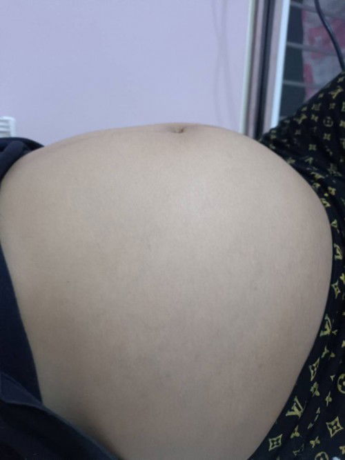 ท้องเล็กแบบนี้ ผิดปกติไหมคะแม่ๆๆ