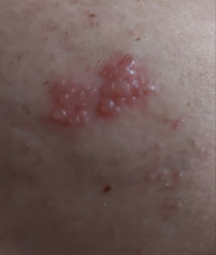 Skin problem...