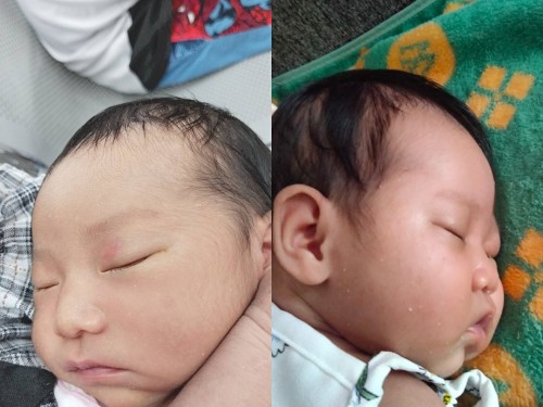 28วัน น้องภีม