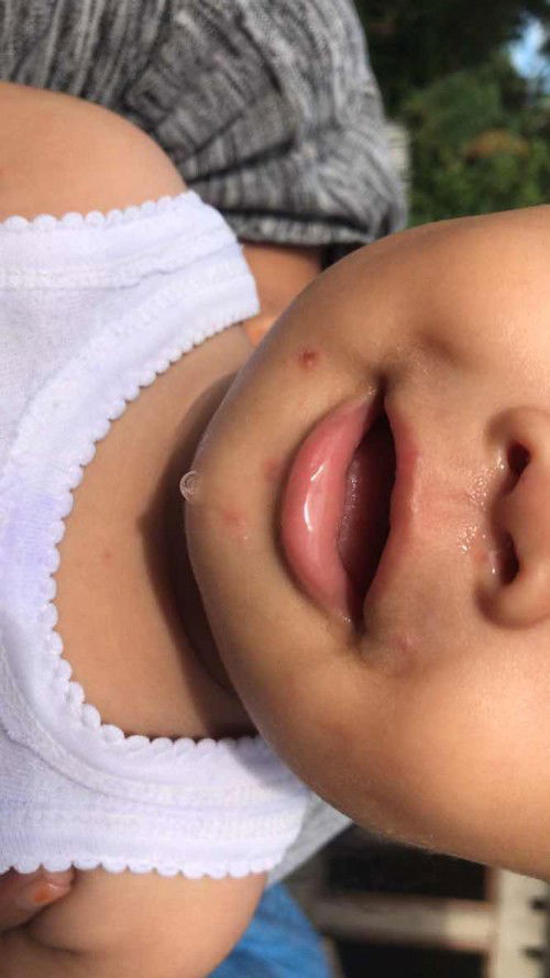 Tentang kesehatan anak