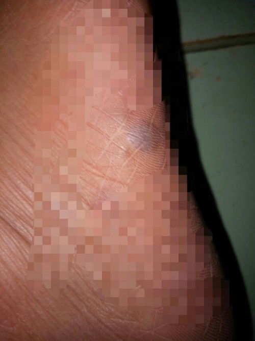 Butlig na itim at puti