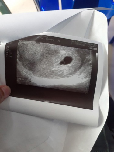 Transvaginal Ultrasound