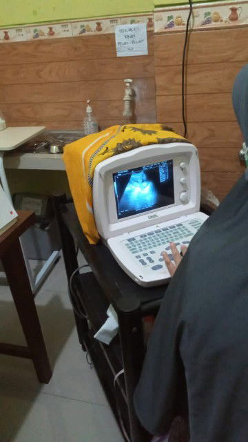 bun ada yg sama kah tdi siang aq USG kata dokternya ari" si bayi d bawah jdi worini bun ada yg sama