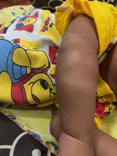 Putih putih seperti jamur di badan dan kepala bayi kenapa ya??
Dan tips cara mengatasinya?