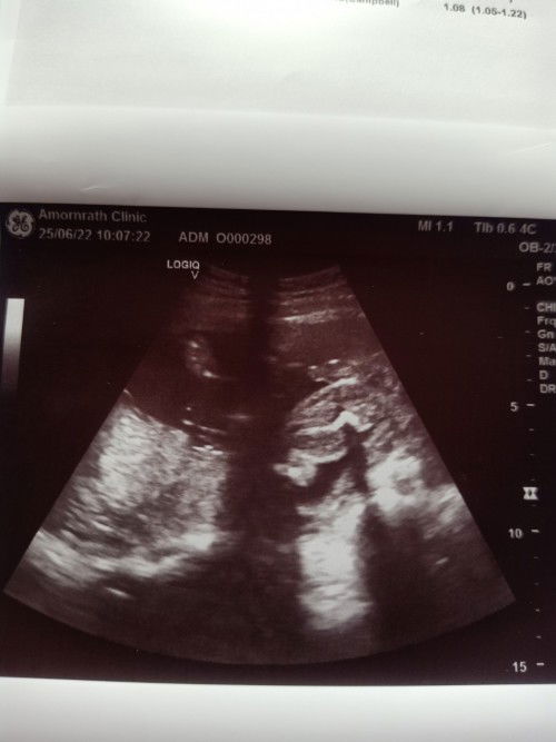 ช่วยดูให้หน่อยค่ะ