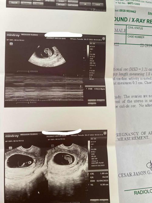 hello pooo pacheck naman po neto