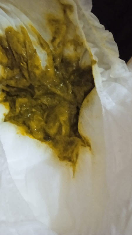 Pup dede sesudah mkn kok kya gtu