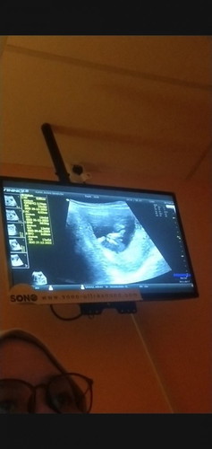 Geng jan2023 dh scan ?