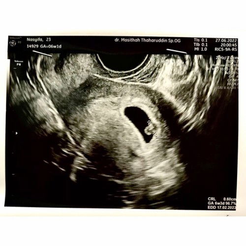 Masyaallah Tabarakallah USG 6w