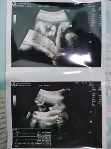 ลูกกลับหัว