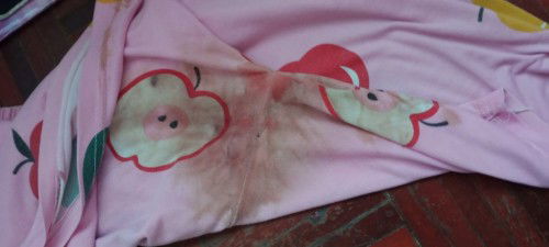 คุณแม่ตั้งครรภ์