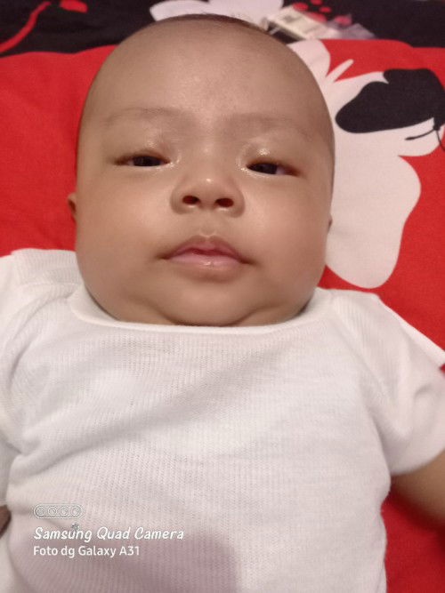 Kelopakmata merah setelahmenangis