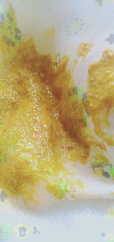 ลูกถ่ายมีมูกเลือดปนเป็นเส้นนิดๆ
บ้านไหนเป็นบ้างค่ะ  แล้วต้องทำไงแนะนำหน่อยค่ะ