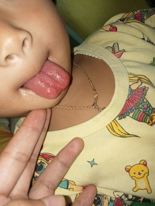 Lidah anak bulat² merah