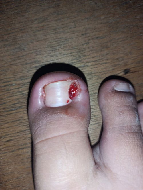 Pa help po mga mommys