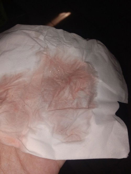 Bangun tidur keluar cairan warna pink apakah bahaya? 36week
