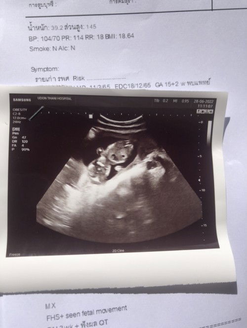 ข้อสอบถามแม่ๆหน่อยค่ะ 👇👇