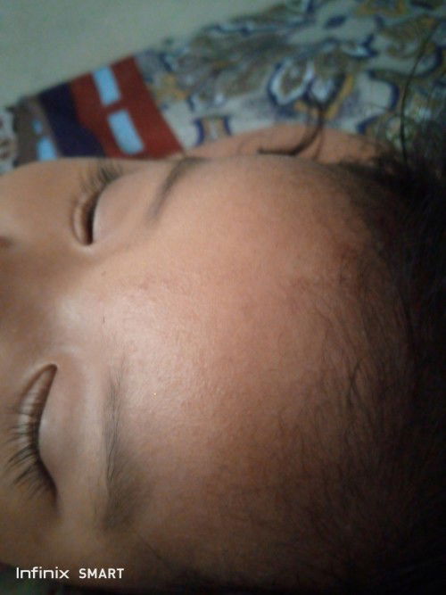 Biang keringat seluruh badam