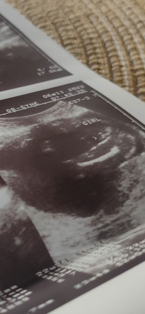 Sure na po bang girl ito?