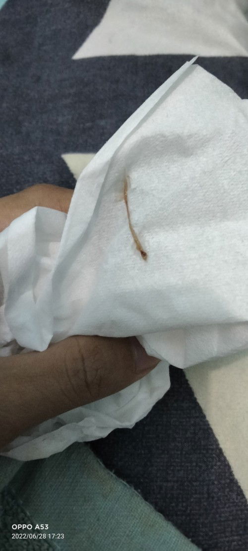 Keluar flek saat usia 31weeks