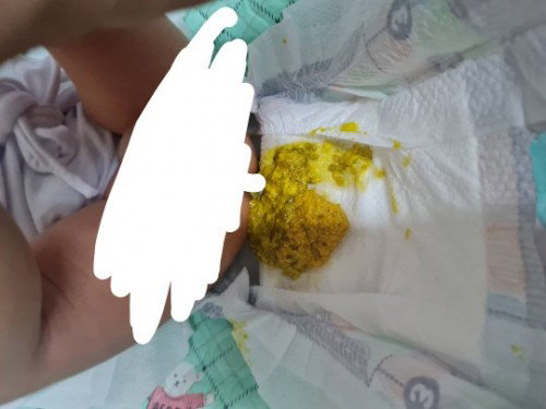 Yelow poop