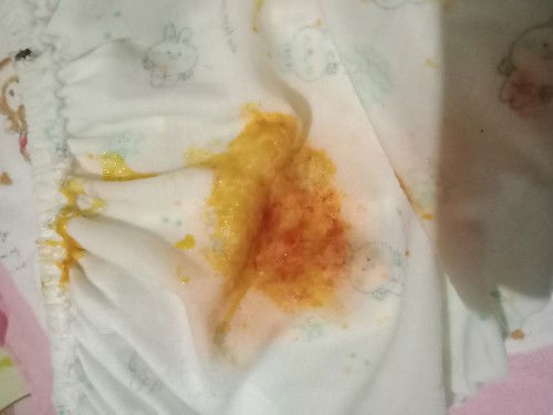 ปรึกษาหน่อยค่ะ