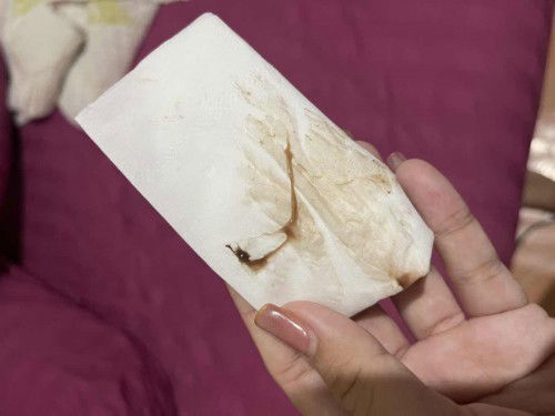 ตั้งครรภ์ 10 Week