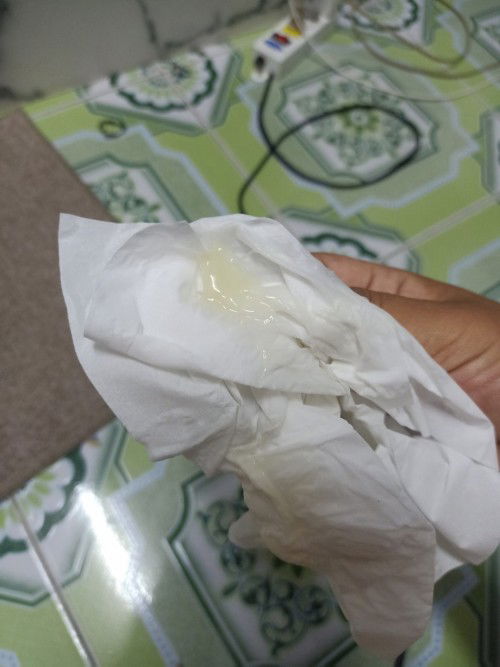 แบบนี้เรียกมูกใสมั๊ยคะ