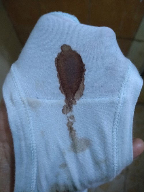 Keluar Darah/Flek saat hamil 13Minggu 2 Hari