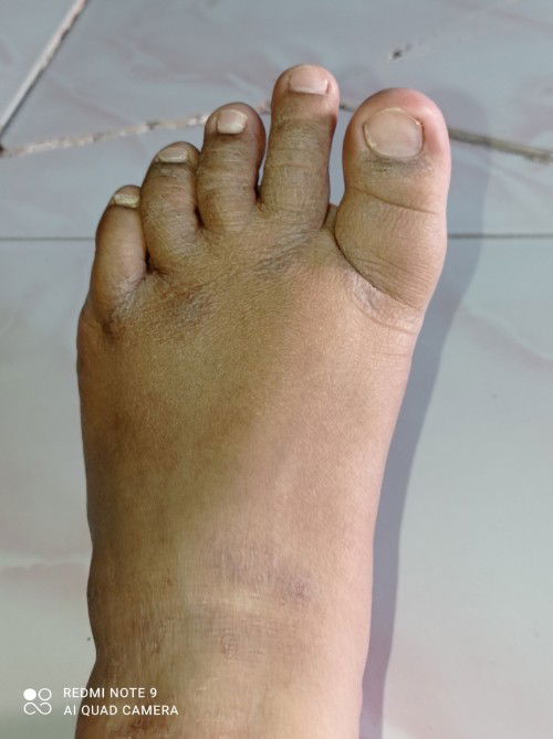 Jamur kaki