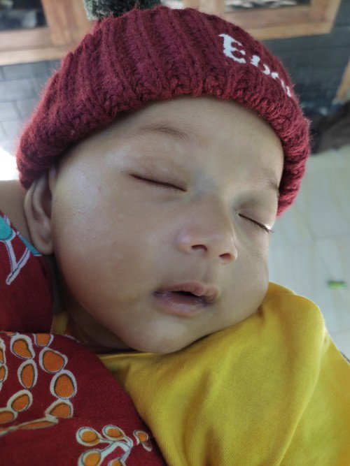 Bercak putih di muka