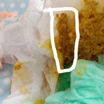 แบบนี้อันตรายมั้ยคะ