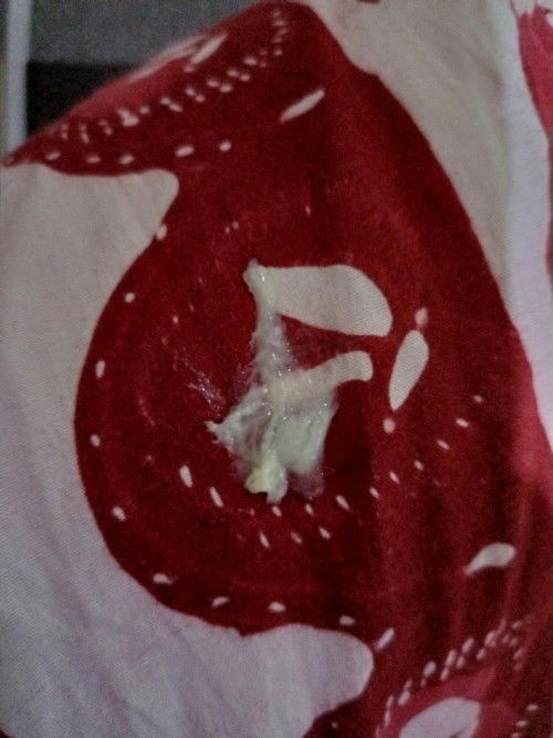 Keputihan saat hamil tua