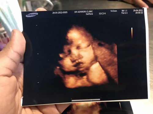 สอบถามแม่ๆหน่อยค่ะ