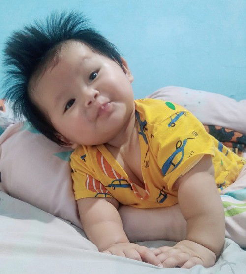 hamil lgi setelah 6 bln Op SC