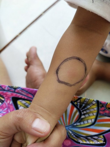 Mantoux tes