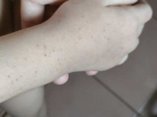 Bun ada yg tau ini kenapa gak yah ?
