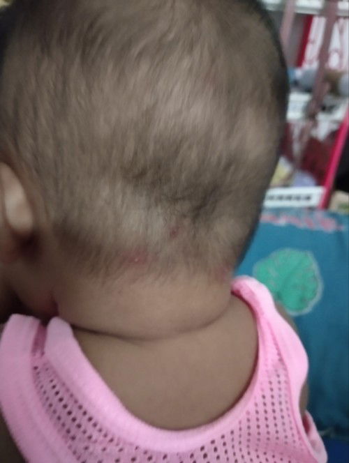 ลูกใครเคยเป็นบ้างค่ะ