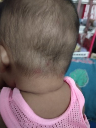 ลูกใครเคยเป็นบ้างค่ะ