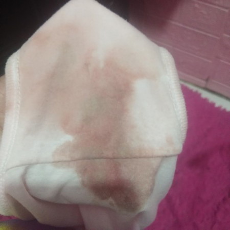 Sino po dito yung IN'IE den after dat tuloy tuloy yung dugo na lumabas? Normal lang ba yun? 2cm