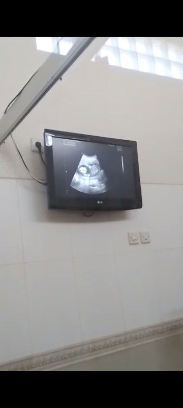 Hasil USG apa bisa berubah