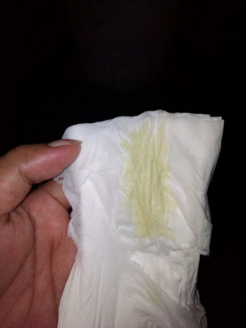 May discharge na gantong kulay pero hnd malapot 
39 weeks pregnant