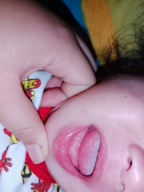 Nag ngingipin na poba sa baby?