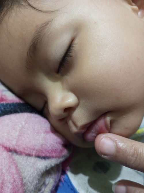 Ini kenapa ya ? Obat nya apa?