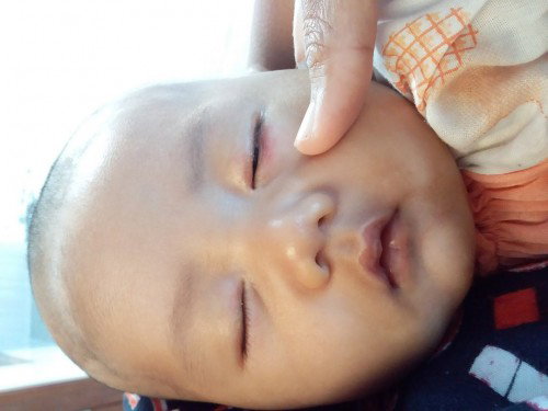 Bagi infonya dong bun mungkin ada yg mengalami hal yg sama dg bayi saya