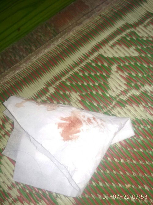 Mau Tanya ini darah apa ya?.. darah implantasi apa darah menstuasi yaa